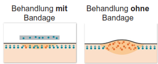 behandlung bionenfaser
