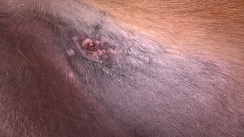 Sarkoid Bionenfasertherapie